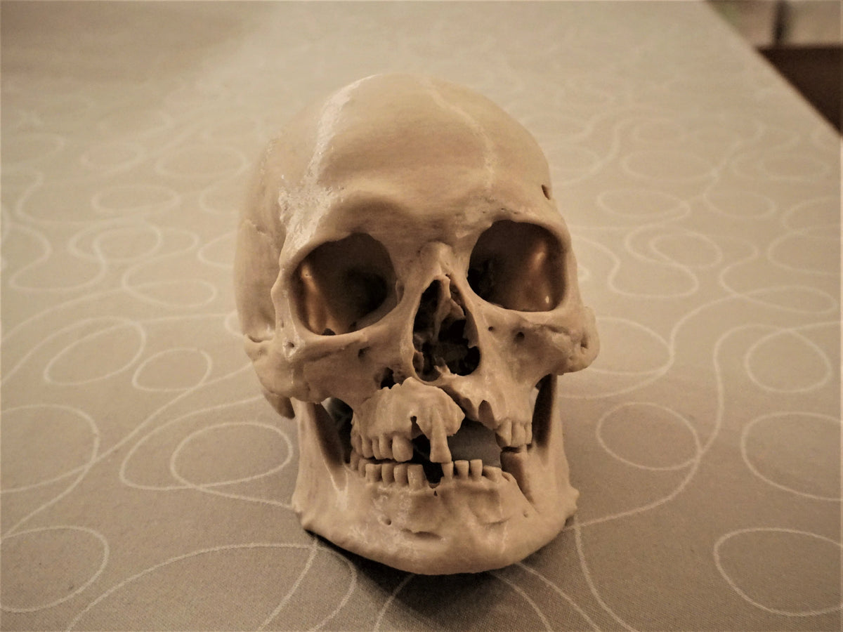 Crâne humain avec blessures de bataille Historiska Museet - Science Print